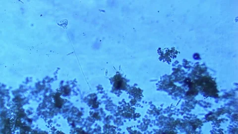 Microorganisms of freshwater ecosystem under microscope-water quality Stock Footage 302708916