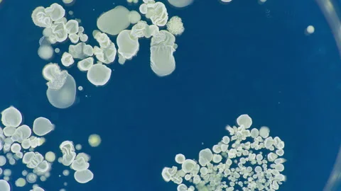 Microorganisms growing in a petri dish Stock Footage 178602076