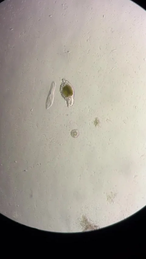 Microorganisms Observed Under Microscope in a Chinese Laboratory Видео 337915509