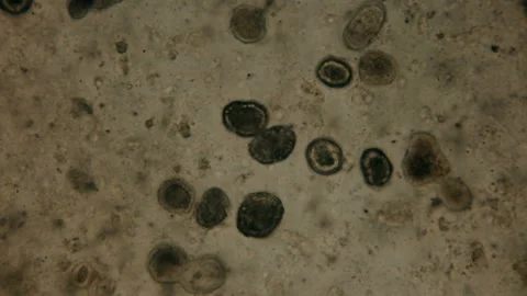 Microorganisms in a protective cocoon to survive adverse conditions under a Stock Footage 87912935