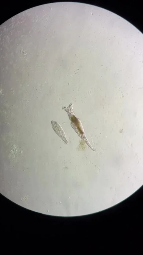 Microorganisms Like Rotifer and Paramecium Under Microscope in China Stock Footage 337915500