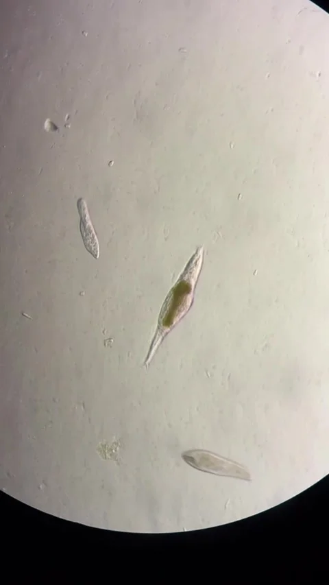 Microorganisms, such as protozoa, moving under a lab microscope in China. Stock Footage 337915488
