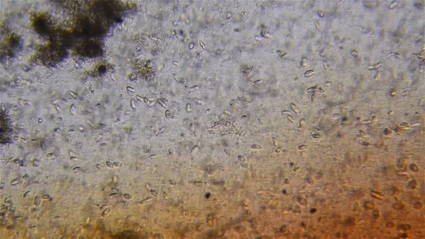 Microorganisms viewed under the optical microscope, which float in a water su Vídeos de archivo 95861180