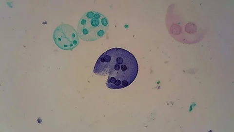 Microscope Algae Volvox 1200x Stock Footage 151735532