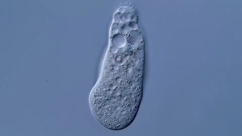 Microscope: amoeba in pond water sample 400x magnification Vídeos de archivo 310311452