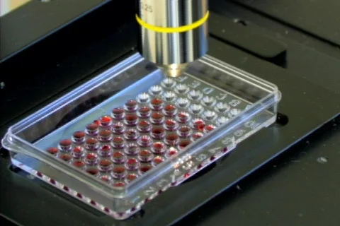 Microscope with blood Stock Footage 99017