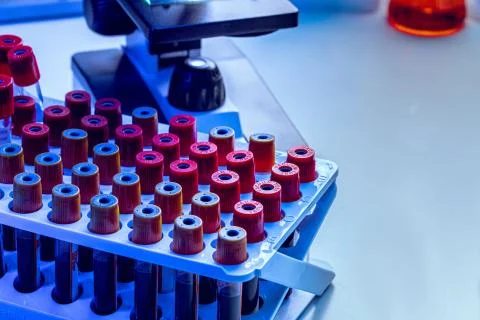 Microscope with blood samples test tubes close up Stock Photos