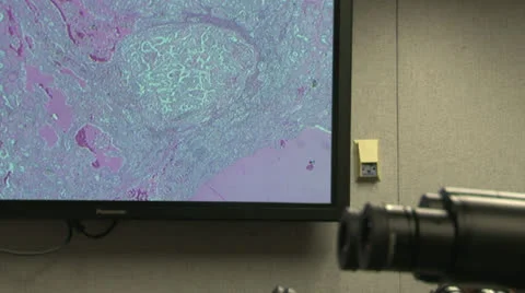 Microscope - Cell on Screen Stock Footage 23361558