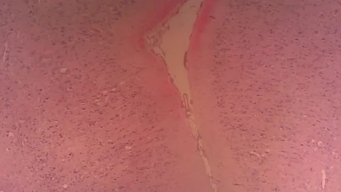 Microscope Cerebrum Mammal Section x1200 Video stock 147159393