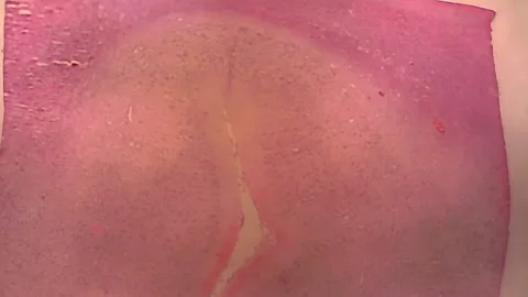 Microscope Cerebrum Mammal Section x600 Video stock 146233451