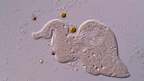 Microscope: Ciliophora dileptus under microscopy 400x magnification Vídeos de archivo 310304330