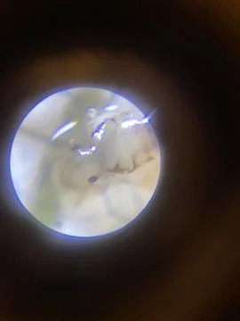 Microscope close up of the head of a live headlouse (Pediculus humanus capitis) Foto stock