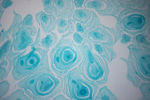 Microscope close-up of a turquoise-stained tissue. Photos