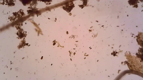 Microscope Freshwater Pond Algae and Plankton Paramecium 500x Stock Footage 131903389