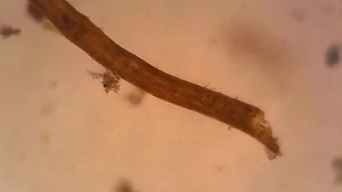 Microscope Freshwater Pond Algae and Plankton Paramecium 1000x Stock Footage 136210889