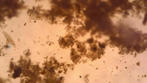 Microscope Freshwater Pond Algae and Plankton Paramecium 1100x Vídeos de archivo 139427899