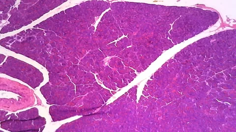 Microscope Human Pancres Islet 1200x Video stock 141457141