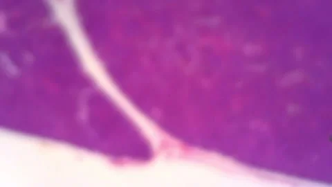 Microscope Human Pancres Islet 1200x Slide In Video stock 142272912