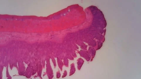 Microscope Human Small Intestine Section 1200x Video stock 144219612