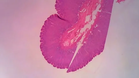 Microscope Human Stomach Walls Section 1000x Video stock 144685204