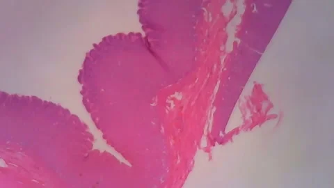 Microscope Human Stomach Walls Section 1200x Slide In Video stock 145341644