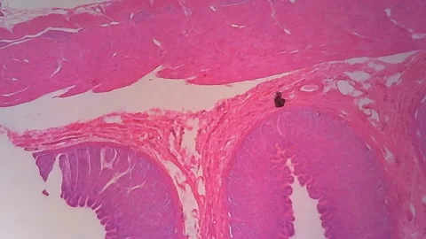 Microscope Human Stomach Walls Section 1000x Focusing Video stock 145856195