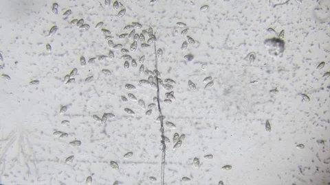 Microscope image footage of protozoa microorganisms in water Stock Footage 76811168