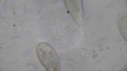 Microscope image footage of protozoa microorganisms in water Stock Footage 76813125