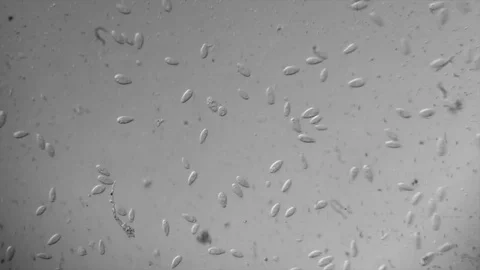 Microscope image footage of protozoa microorganisms in water Stock Footage 76813452