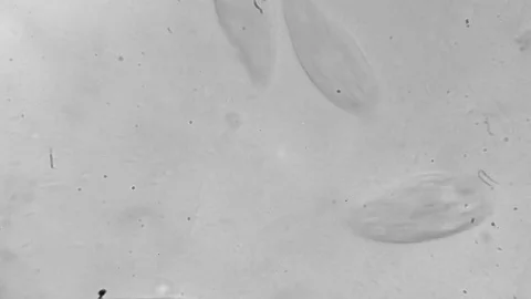 Microscope image footage of protozoa microorganisms in water Stock Footage 76813567