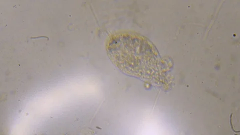 Microscope image footage of protozoa microorganisms in water Stock Footage 99598461