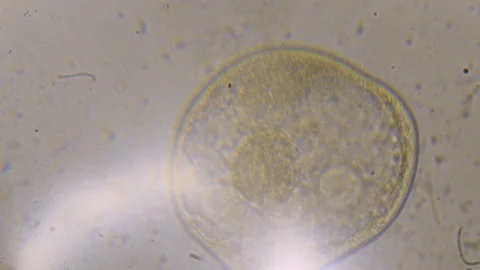 Microscope image footage of protozoa microorganisms in water Stock Footage 99598493