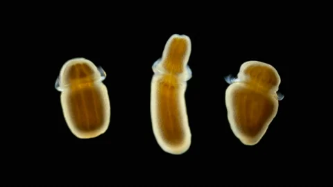 Microscope larva of Zoanthina under the microscope, class Anthozoa Stock Footage 125552016