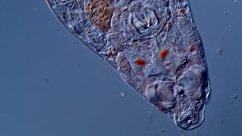 Microscope: Live rotifer in pond water sample 스톡 동영상 310313324