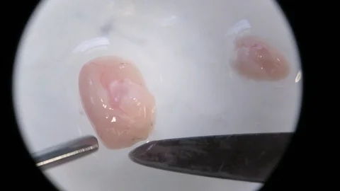 Microscope mouse brain dissection scalpel hippocampus continued Stock Footage 92623018