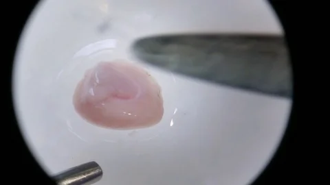 Microscope mouse brain dissection scalpel hippocampus Stock Footage 92626560