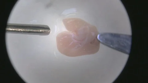 Microscope mouse brain dissection with scalpels Stock Footage 92622914