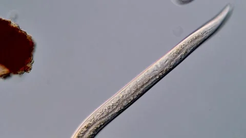 Microscope: nematode larvae 400x 库存影片 310495839