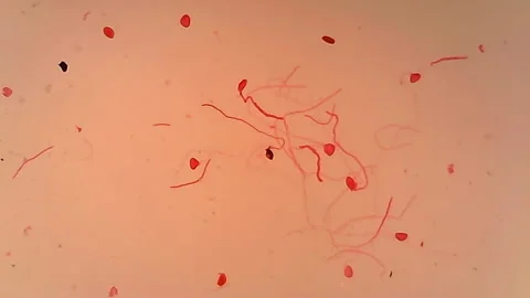 Microscope Pollen Gem Whole Mount x600 Stock Footage 142273973