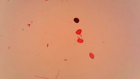 Microscope Pollen Gem Whole Mount x1200 Stock Footage 142905073