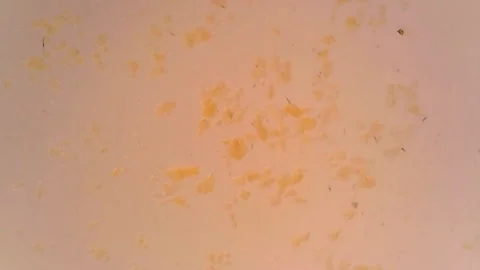Microscope Pome Sclereid Whole Section x1200 Stock Footage 150914435