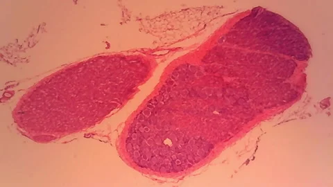 Microscope Rabbit Ganglia Section x1000 Video stock 145341913