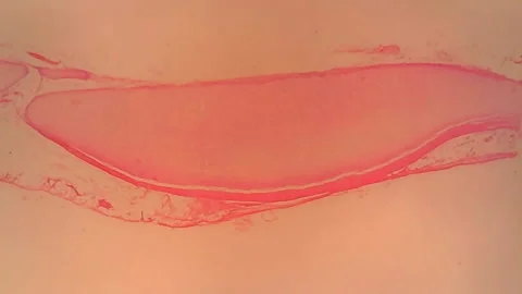 Microscope Rabbit Hyaline Cartilage x300 Video stock 144220175