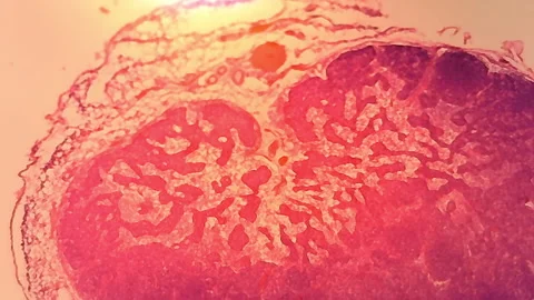 Microscope Rabbit Lymph Node Section x500 to x800 Stock Footage 144686480