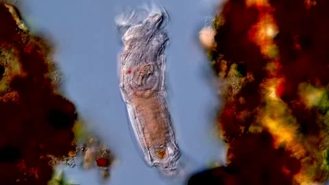 Microscope: Rotifer, 400x magnification 库存影片 310311006