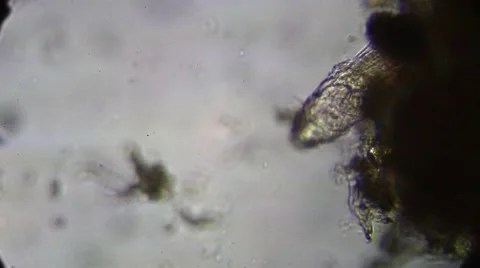 Microscope - Rotifer Mniobia Magna Stock Footage 57232020