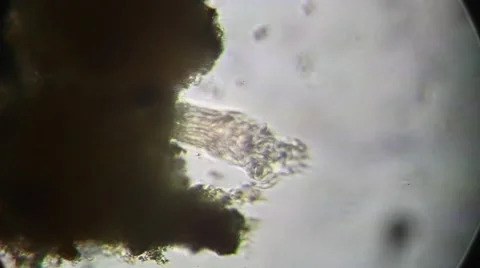 Microscope - Rotifer Mniobia Magna Stock Footage 57232054