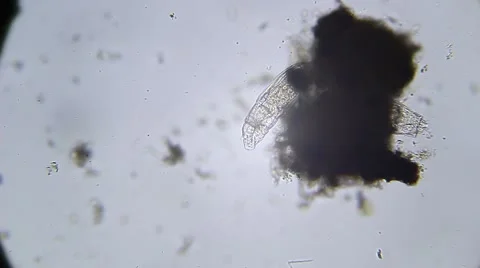 Microscope - Rotifer Mniobia Magna Stock Footage 57232071
