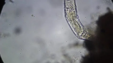 Microscope - Rotifer Mniobia Magna Stock Footage 57232130