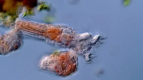 Microscope: Rotifera under microscopy view 库存影片 310311383